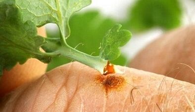 How to get a warmer with a Celandine