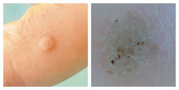 Ordinary warmer during examination and dermatoscopy