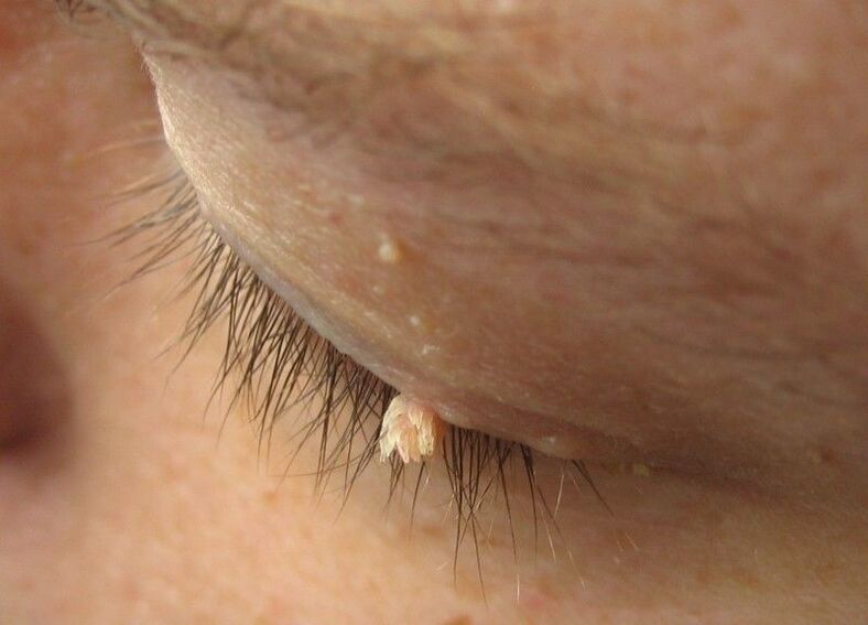Wells in the face of our eyes